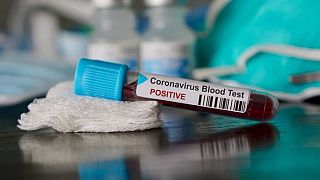 medici coronavirus