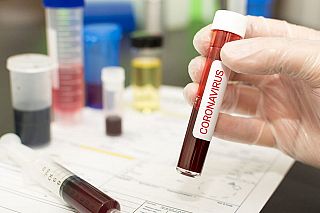Fialette test Coronavirus