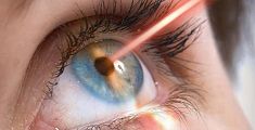 La tecnologia laser al servizio degli occhi