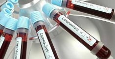 Coronavirus, 1501 nuovi casi e 7 decessi