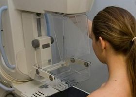 Screening gratuiti contro il tumore al seno