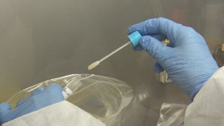 Tampone oro-naso-faringeo in laboratorio