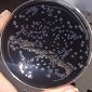 Polmonite da legionella, una donna gravissima